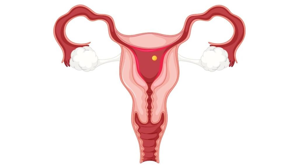 adenomyosis treatment in malad west at ahura nursing home